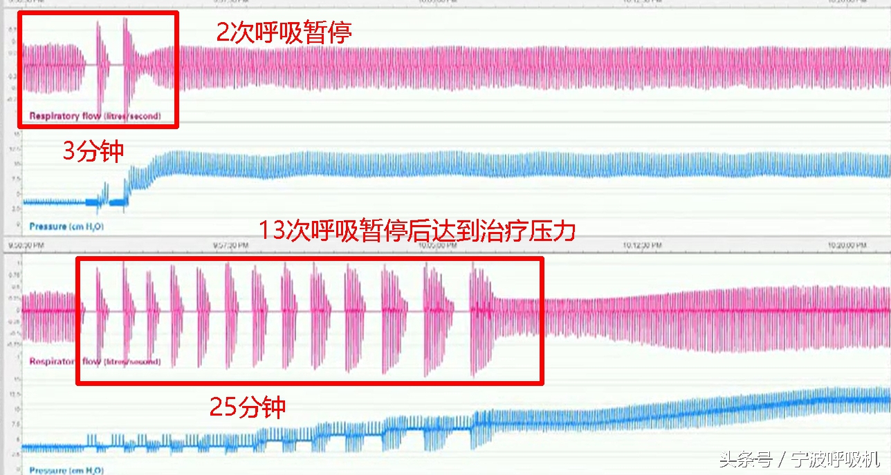 瑞思迈s9autoset-s的价格,瑞思迈s9autoset-s评测