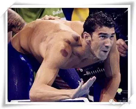 里约奥运会拔火罐,奥运会纹身