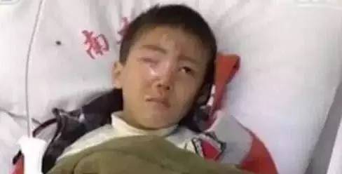 食品干燥剂炸伤小孩眼睛,食品干燥剂8岁男童