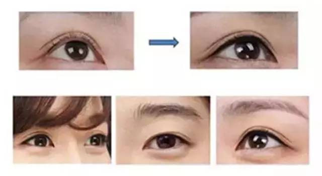 美瞳线太粗,美瞳线太粗了怎么办