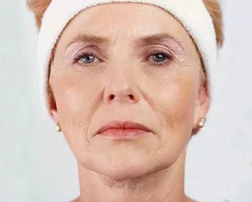 老了皱纹一年比一年多了,老了真的老了脸上布满皱纹