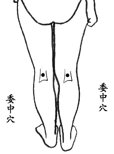 腰椎痛按委中穴,委中穴能够治疗腰椎间盘突出吗