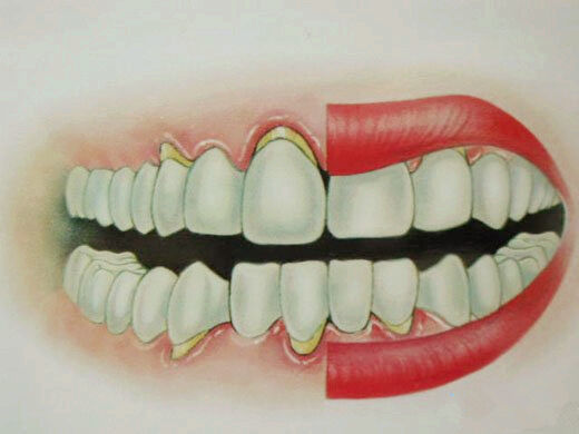 飞利浦电动牙刷刷牙示范,你真的会刷牙吗高清图片