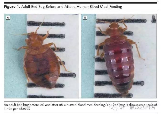 臭虫叮咬严重吗,被臭虫咬什么感觉