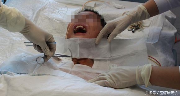 愚钝母亲参照网络看病，竟用菜刀割开孩子脖子！