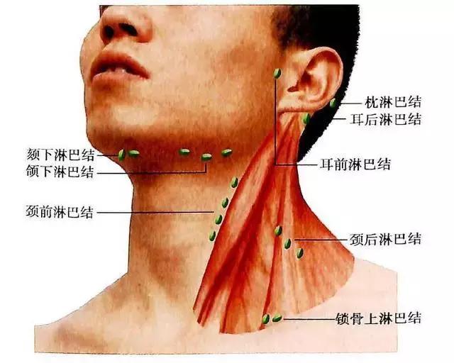 脖子上长了淋巴结要该怎么治,脖子淋巴结和腋下淋巴结都有肿大