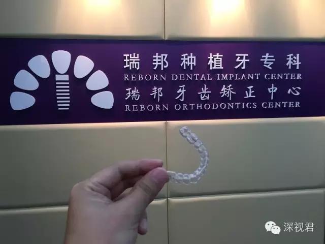 牙齿矫正舌侧牙套经历分享,牙齿矫正隐形牙套真人日记