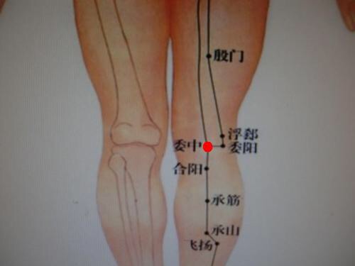 腰椎痛按委中穴,委中穴能够治疗腰椎间盘突出吗