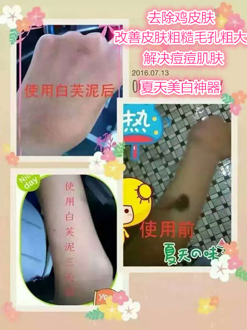 瓷肌祛黄效果怎么样,瓷肌白祛斑怎么样