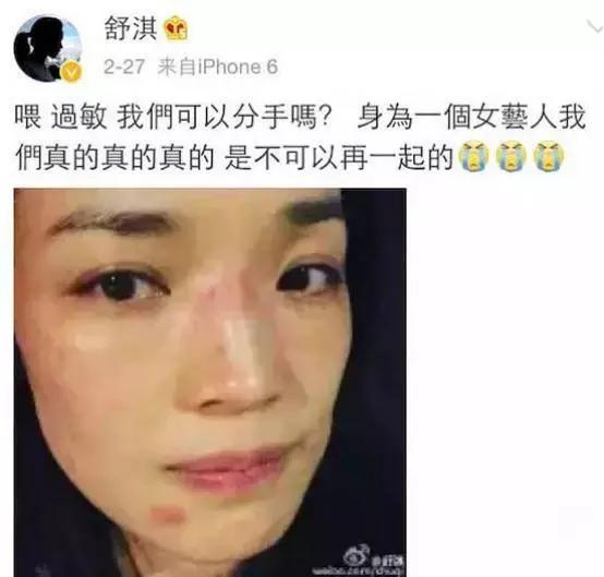 名医专访,行家医生谈敏感肌肤