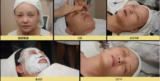 名医专访,行家医生谈敏感肌肤