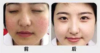 名医专访,行家医生谈敏感肌肤