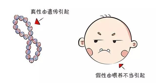 用奶瓶喝奶地包天怎么矫正,宝宝地包天和奶瓶有关系吗