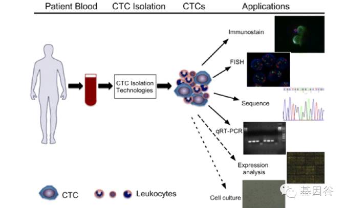 循环肿瘤细胞ctc检测技术,液体活检ctc多少费用
