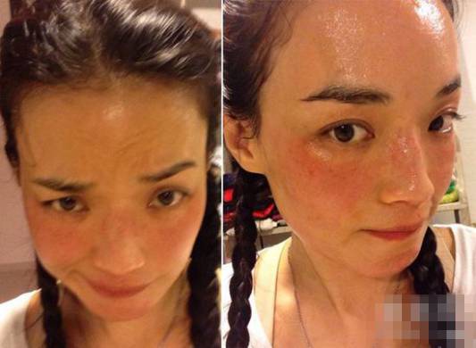 名医专访,行家医生谈敏感肌肤