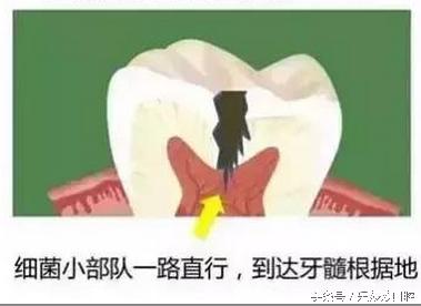 牙疼真要命说法是真的吗,牙疼是身体的什么预兆