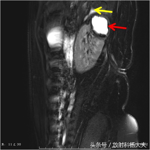 花季少女腰疼是什么原因,青春期女生为什么总是腿痛