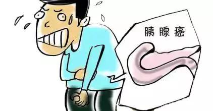 乔布斯5000万治疗癌症,乔布斯死于癌细胞的征兆