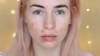 有闭口痘痘化的妆,脸上有粉刺痘痘怎么化底妆