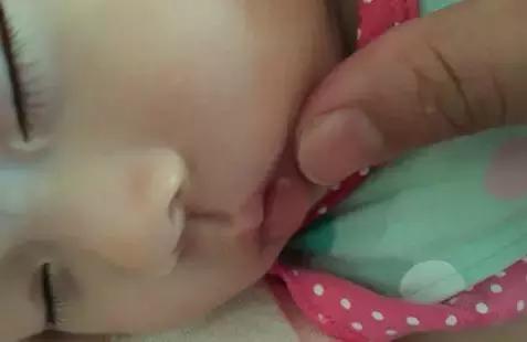 宝宝口腔溃疡一直不好怎么办,一周半宝宝长口腔溃疡怎么办