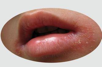 美白丸怎么用才是正确的,真正有效的美白丸产品