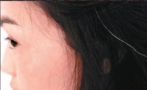 白头发中医治疗快还是食疗比较快,青年人吃什么能够预防白头发