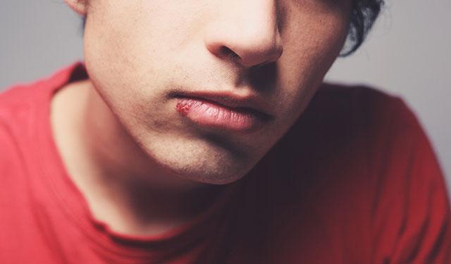 经常上火的人怎么调理嘴上长泡,吃上火嘴上长了个泡泡怎么办