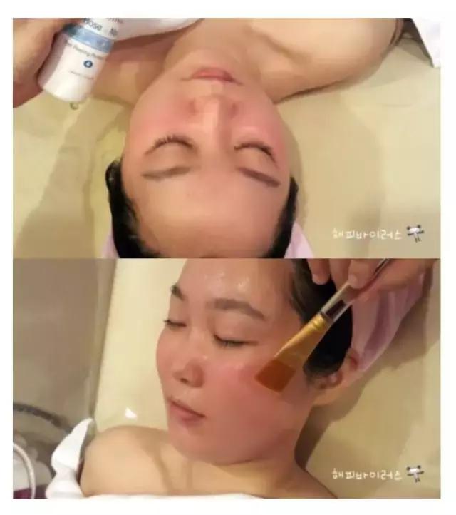 美肤美容项目,美肤祛斑的美容项目