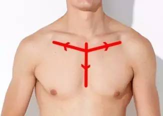 慢性咽炎喉咙痒干咳怎么调理,确定为慢性咽炎要做哪些检查