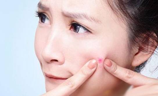 长了痘痘怎样快速祛痘,长痘痘的原因和改善方法去解决