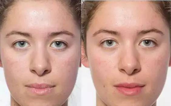 熬夜会让你变得多丑,熬夜变丑了还要继续熬夜么