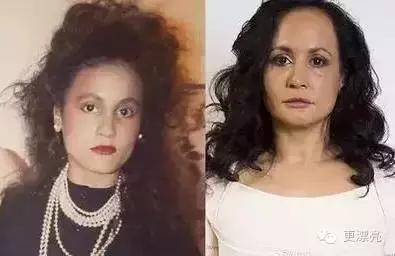 爱笑的女孩只有法令纹,果然爱笑的女孩法令纹很重了