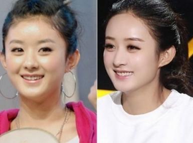 法令纹这么显老得如何搞定,最显老的法令纹解决方法