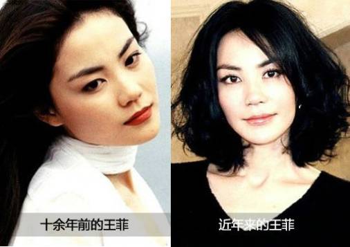 王菲的童颜针是什么牌子,王菲代言的童颜针好吗