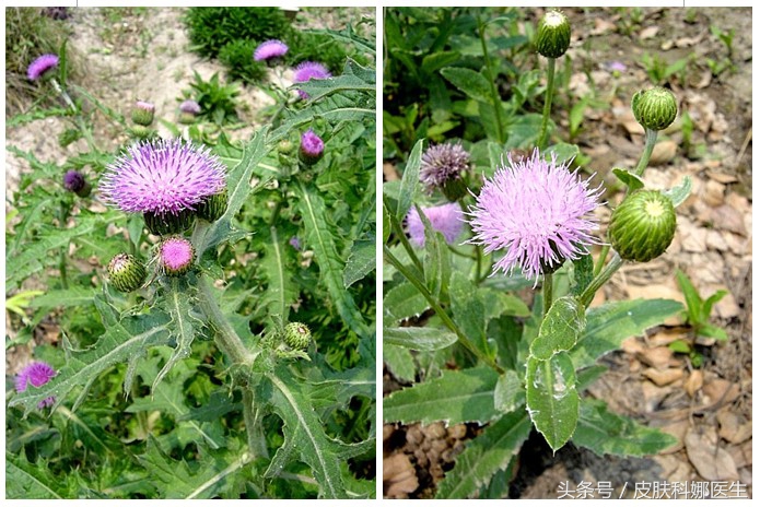 野生刺菜能治什么病,大刺菜的野菜治什么病