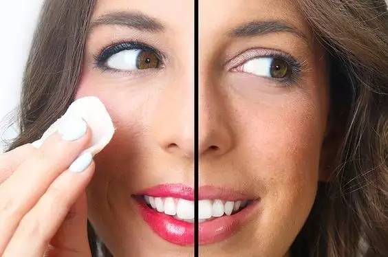 U天使热议丨祛痘告捷堪比换脸？不信你问问她