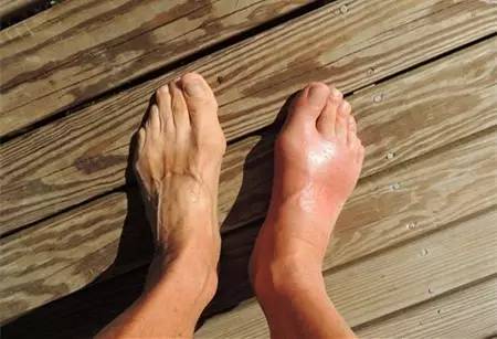 食物嘌呤排行榜能帮助到大家,食物嘌呤含量一览表word