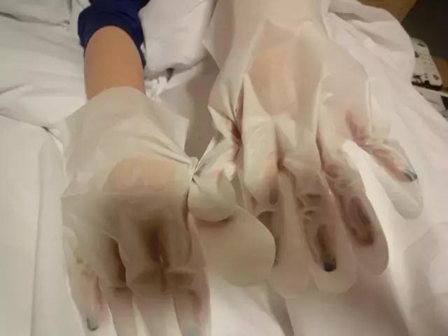 秋冬手部干燥粗糙肿么办？用对产品让你摆脱大妈手！