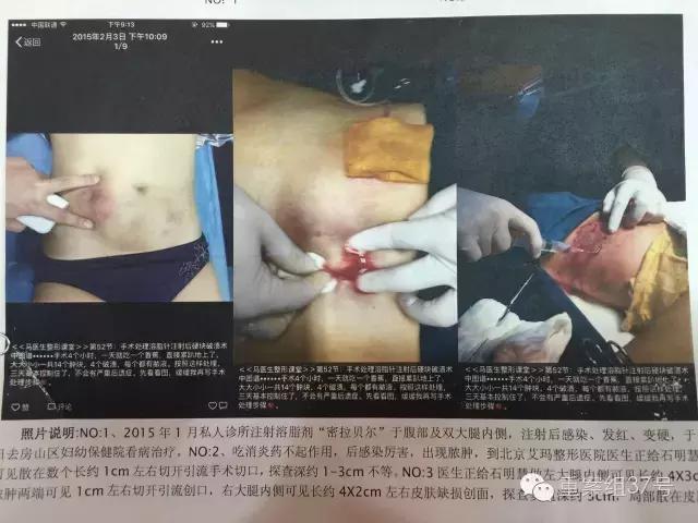 留学生代购被骗,女留学生被诈骗500多万