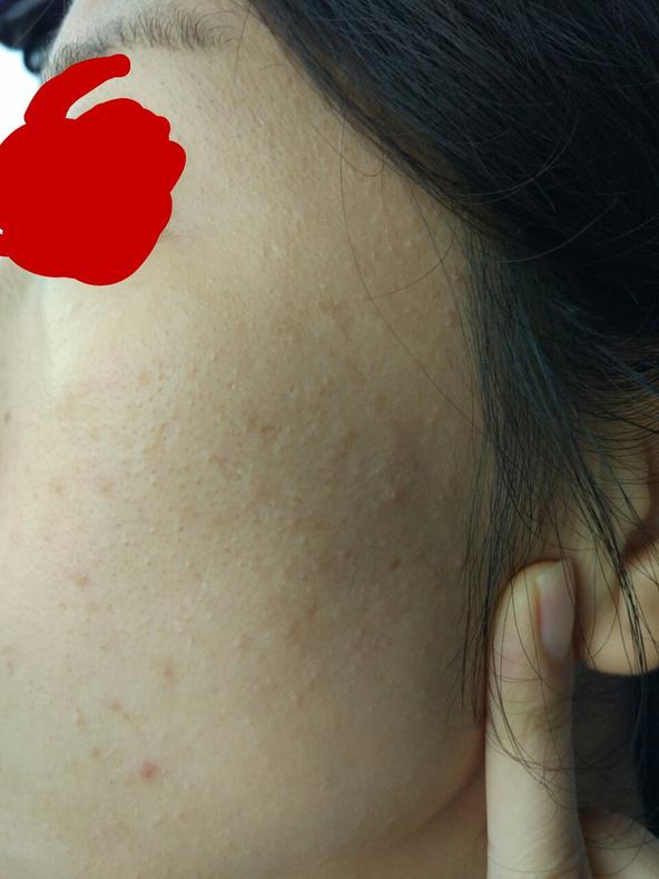 精准护肤问答,护肤问答每天解决一个小问题