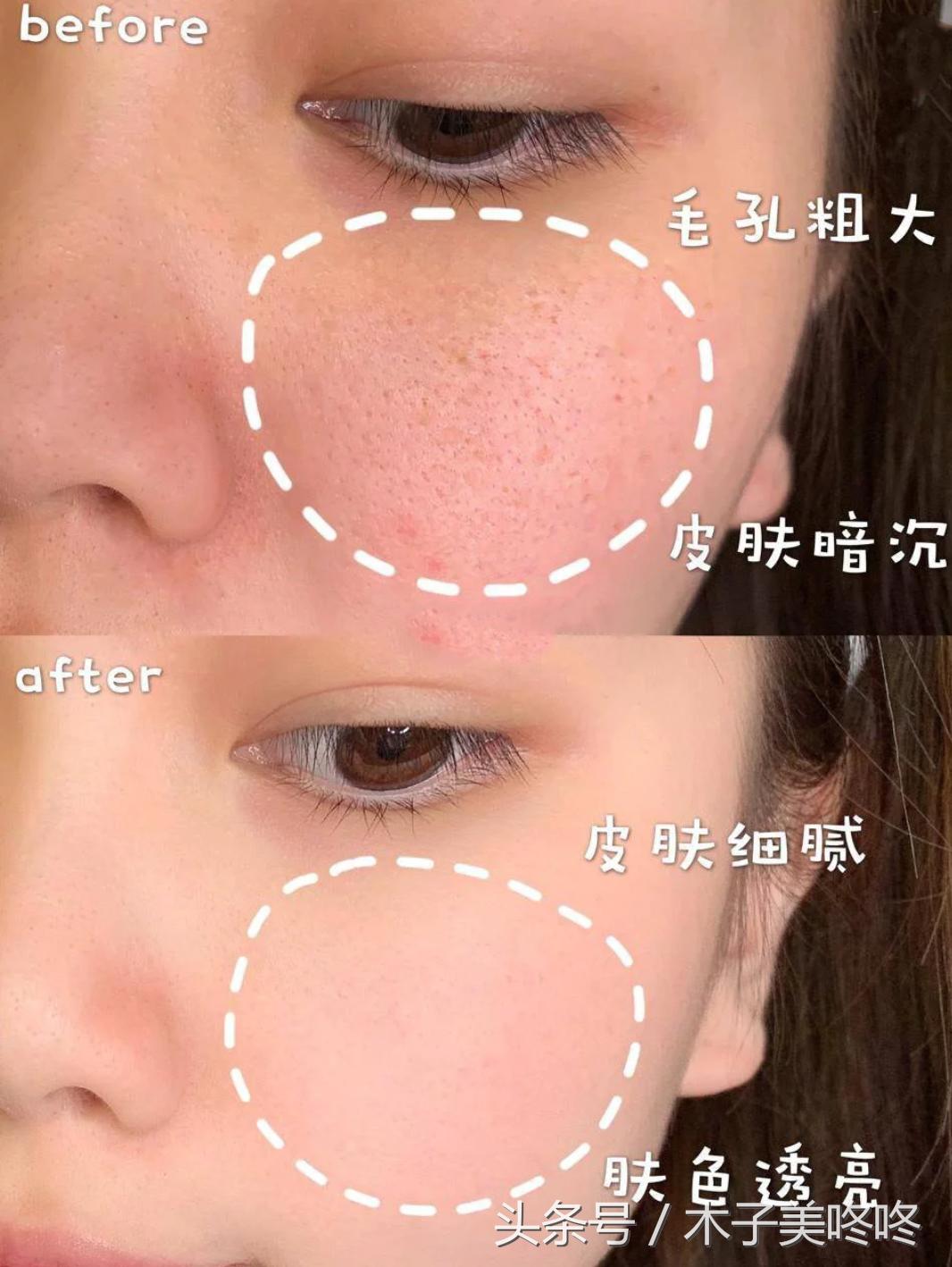 用完就烂脸的爆红洗面奶,三种公认烂脸的洗面奶