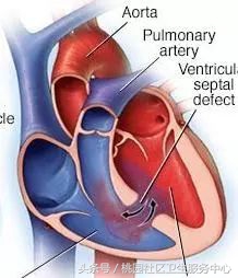 心脏支架说明书,这份通俗易懂的心脏说明书请收好