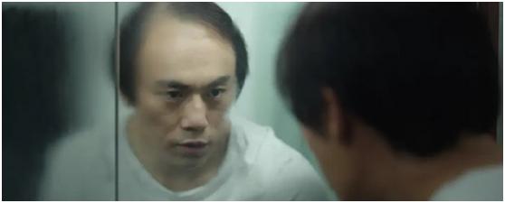 隐秘的角落脱发,秃头怎么办才能防脱发