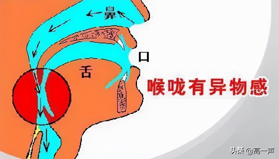 喉咙有时候堵有时候不堵什么原因,喉咙堵得慌打嗝就舒服一会又会堵