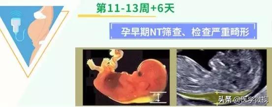 避孕套挤进宅家热销榜前十！怀孕这件事，请做好这2个准备