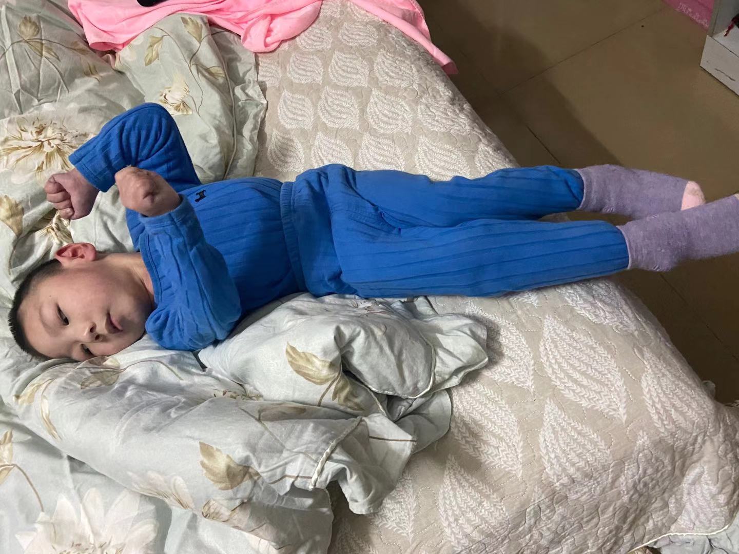 脑瘫奇迹,脑瘫儿等待奇迹