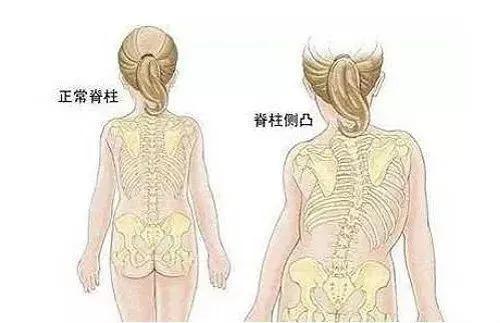 脊柱健康百病消,脊柱调理百病消