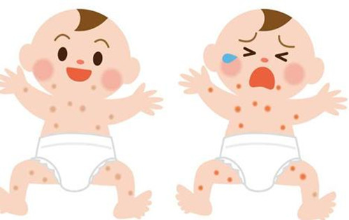 婴幼儿湿疹是什么原因造成的,婴幼儿湿疹是什么原因引起的