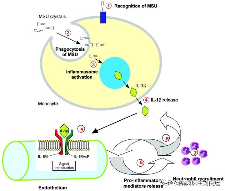 降尿酸能够使痛风结晶溶解吗,吃药降尿酸会损坏肾功能吗
