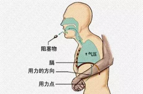 9月大宝宝吃山竹卡住窒息，刚好邻桌就是医生！太幸运！